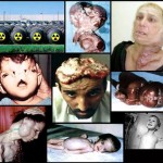 War Crime: Zionist Uranium Attacks in Gaza Causes Rise in Cancer