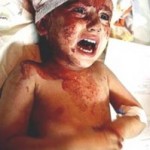 The Truth About the Bloody Zionist Terrorism against the People of Gaza!